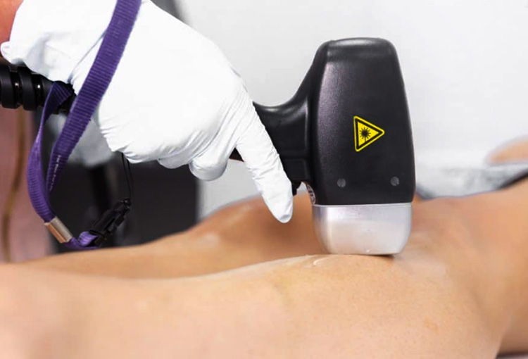 Diode laser hair removal machine 1600 watt diode laser ice machine 808nm diode laser