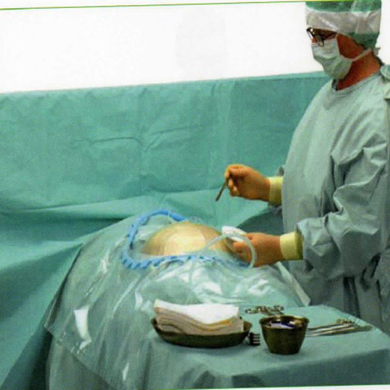 Disposable Nonwoven Sterile C-Section Pack Set