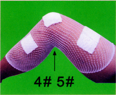 Elastic Net Bandage Used for Knee